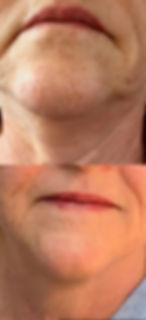 3 treatments-age 67-vertical.jpg