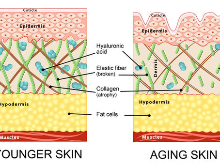 cutaway diagram of younger and older skin