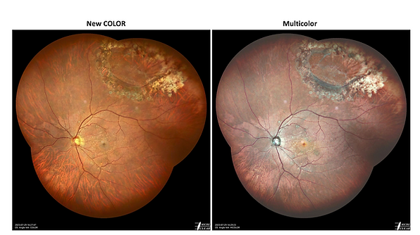 Apollo New COLOR & Multicolor (trascinato).png