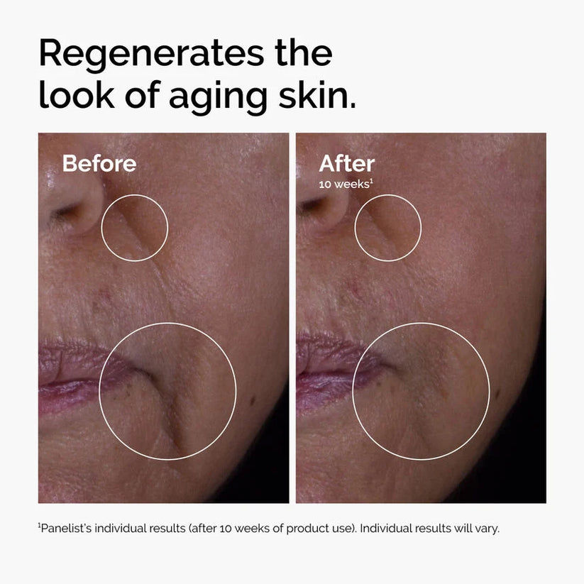 Thumbnail: The Ordinary GF 15% Solution