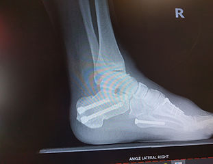 xray.jpg