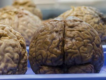 BiologÃa del cerebro y la conducta humana