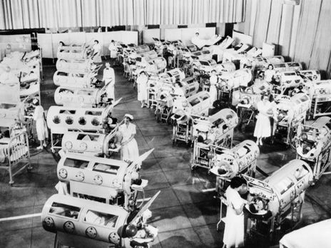 Polio Vaccines Now The #1 Cause of Polio Paralysis