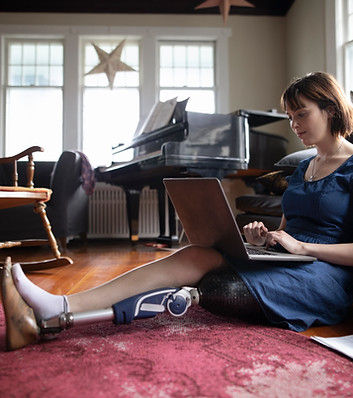 Woman with Amputee Using Laptop