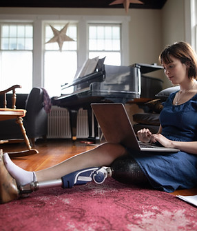 Woman with Amputee Using Laptop