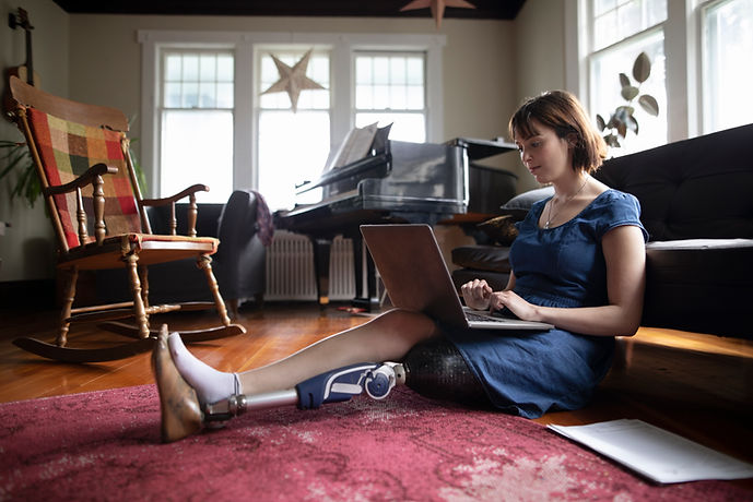 Woman with Amputee Using Laptop