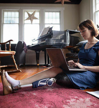 Woman with Amputee Using Laptop