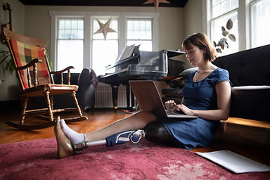 Woman with Amputee Using Laptop