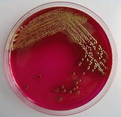 E. coli-H2-2-1_1.jpg