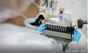 Malária: Anvisa autoriza teste em humanos de vacina 100% brasileira
