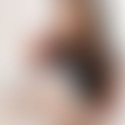 Treating Your Neck: Just as Important as Your Face