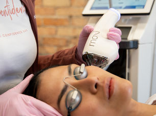 Laser Treatments That Leave Us Beaming