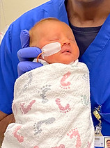 A critically-ill infant due to high hemoglobin levels. Timely treatment facilitated rapid recovery.