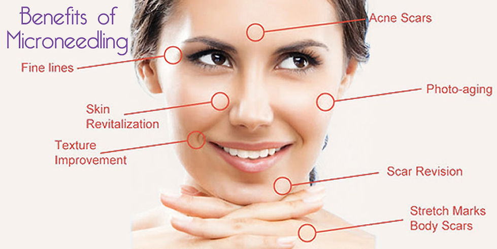 Microneedling Therapy