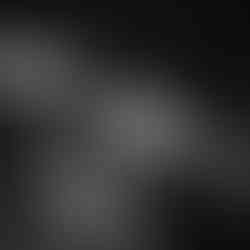 Black and white close-up photo of wired microphone on a mic stand with stage lights glimmering in the background