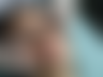 Transform Your Look with Dermal Fillers and Peels