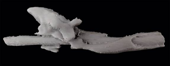 Biomodelo físico resultante da impressão 3D, mostrando a anomalia e sua distribuição espacial ao redor do tubo traqueal.
