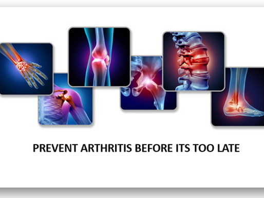 Arthritis Prevention Plan: How to Keep Your Joints Healthy and Pain-Free