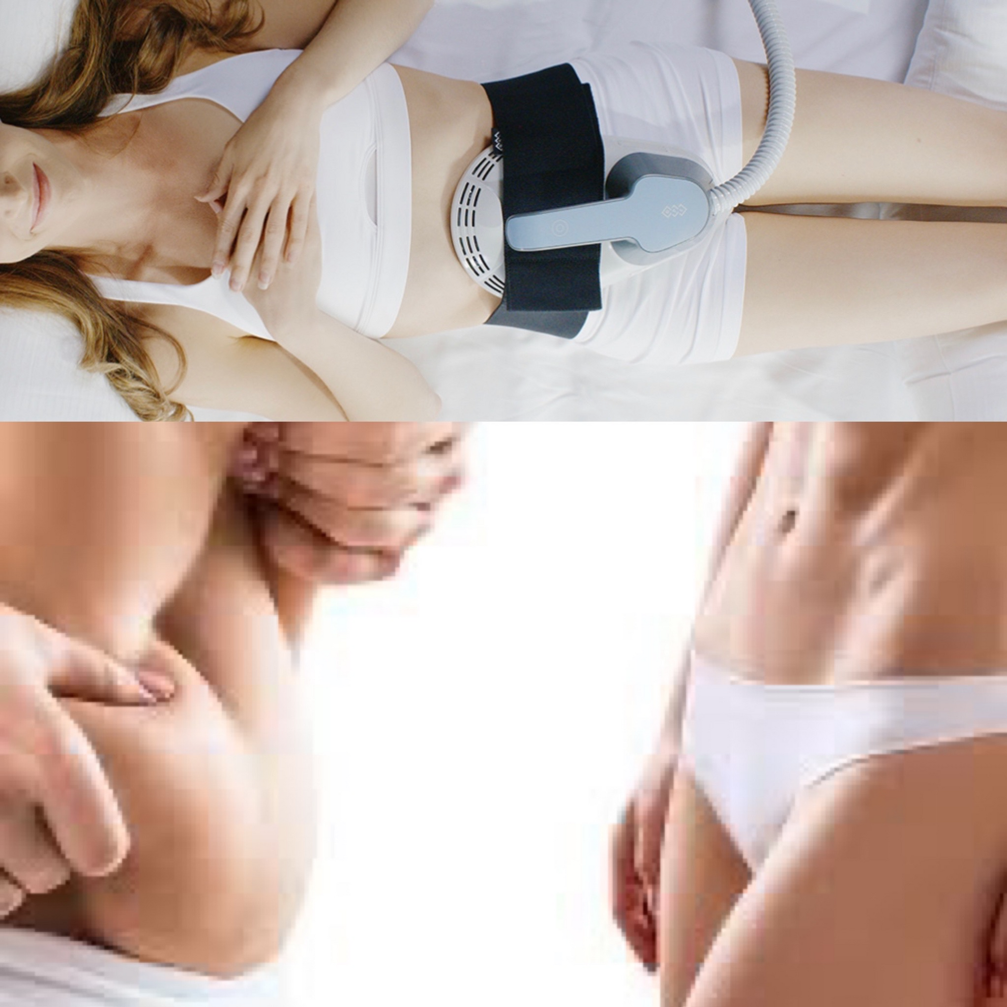 2 EMSHAPE Muscle Toning / Fat Reducing Treatments