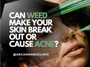 Can Weed Make Your Skin Break Out Or Cause Acne?