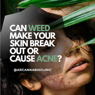 Can Weed Make Your Skin Break Out Or Cause Acne?
