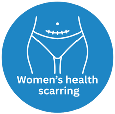 Blue icon with a vector graphic of a woman's c-section scar. The text reads: Women's health scarring