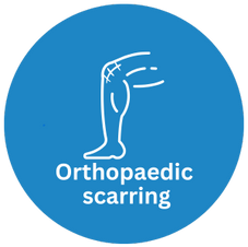 Blue icon with a vector graphic of a scar on a man's knee. The text reads: Orthopaedic Scarring