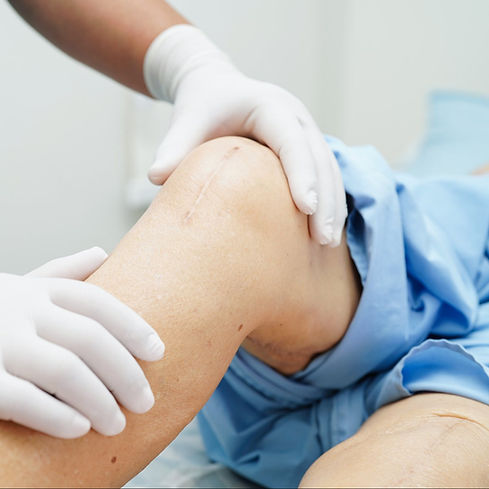 Close up of a faded scar on a knee has the clinician with white sugical gloves holds the leg