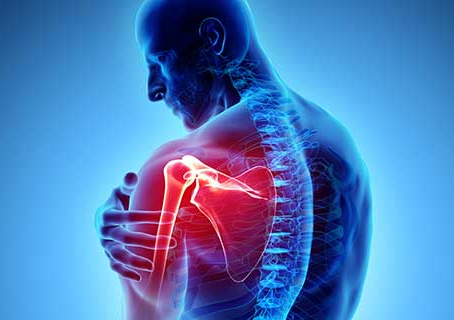 A person with shoulder pain