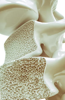 osteoporóza1.png