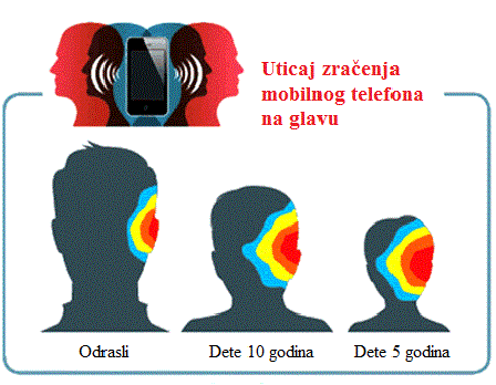 uticaj-na-lobanju-elektromagnetne-radija