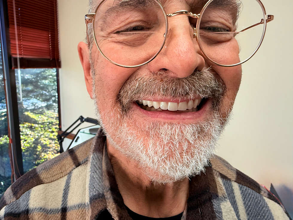 A Happy Patient with New Dentures A satisfied patient showcases his new dentures, which blend seamlessly with his natural appearance. The transformation is remarkable, making it difficult to tell that he is wearing dentures at all.