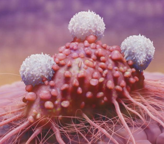 Holistic Cancer Treatment