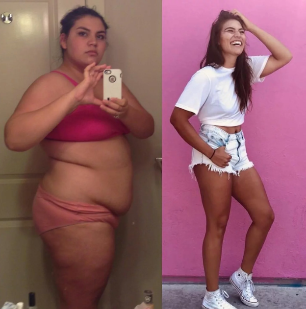 Weight loss Transformation