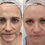 Thumbnail: Obagi Nu-Derm Skin Transformation System Normal to Oily