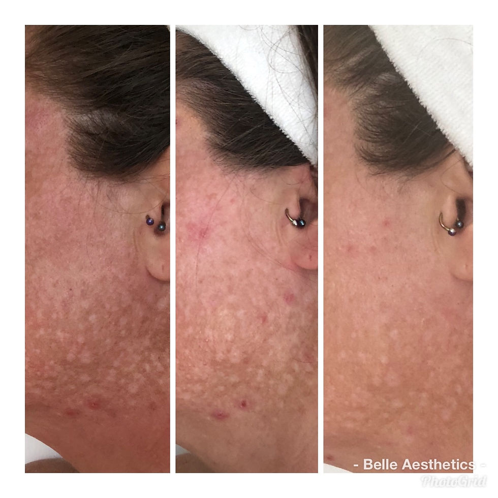 Thumbnail:  Obagi Nu-Derm Skin Transformation System Normal to Dry