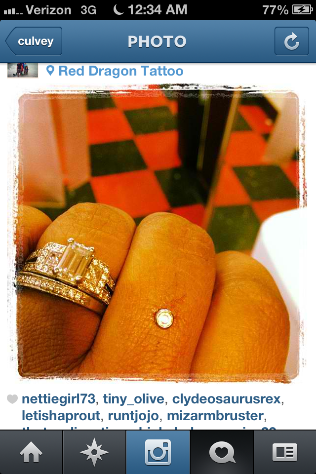 Finger Dermal.PNG