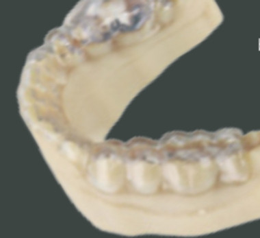 BACKSTAGE-TVI-PRESENTS-INTRODUCING-VERSA