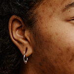 pigmentation on black skin