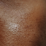 black skin up close