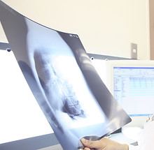 Doctor examining X-ray_edited.jpg
