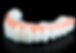 affordable dentures over implants mexico