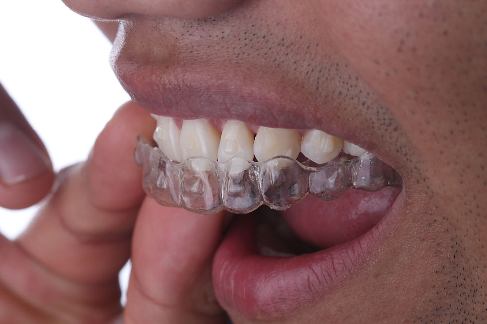Invisible Orthodontics in tijuana Mexico