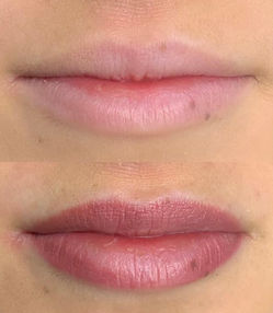 Lips: Before & After | Jo Evans Permanent Makeup | Scotland