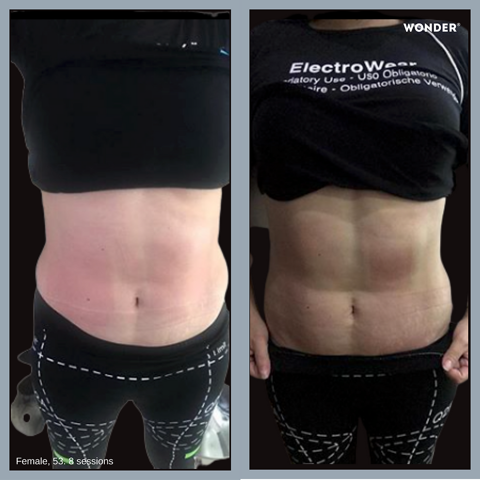 Before and After