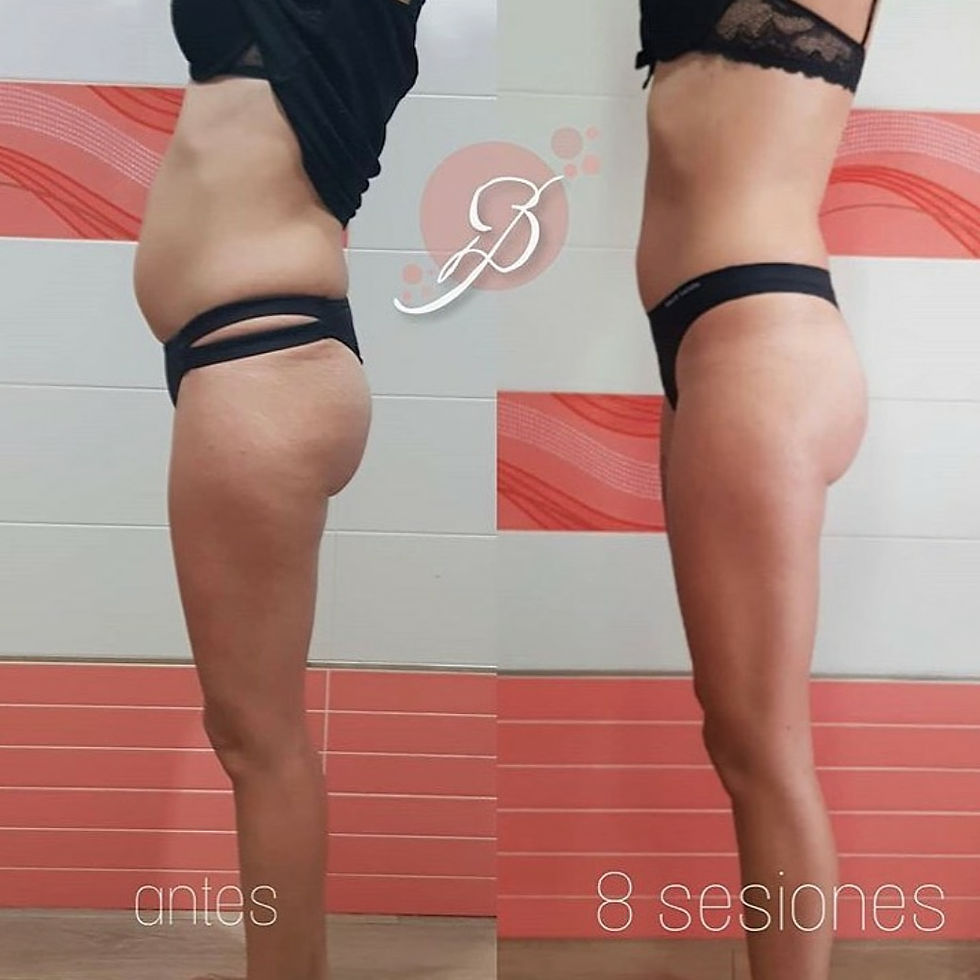 Before and After
