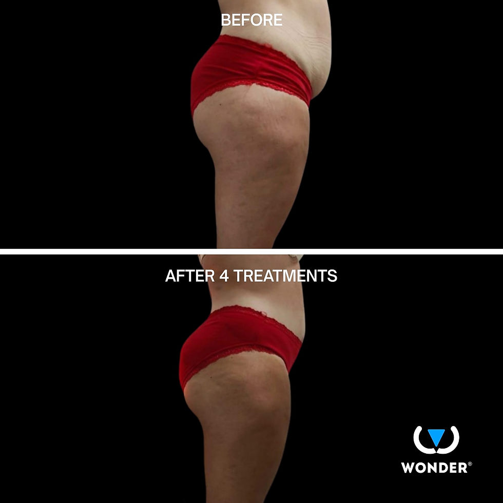 Before and After