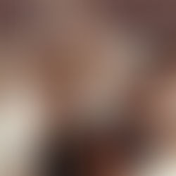 Como escolher minha barra?