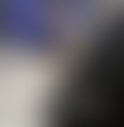 Exchico reality está en estado de coma en Tarapoto