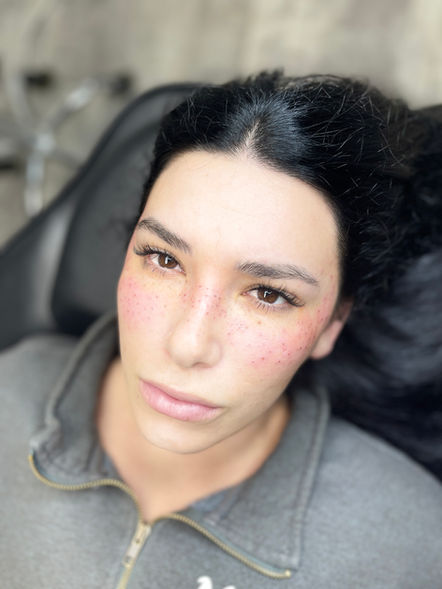 Cosmetic freckle tattoo by Cole Temp Studios in Fairfield, CA.